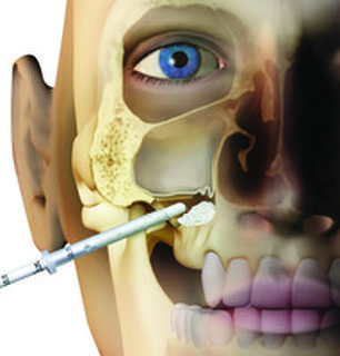 Bone & Membrane
